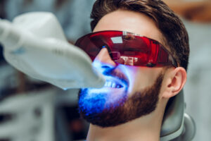 Male Teeth Whitening